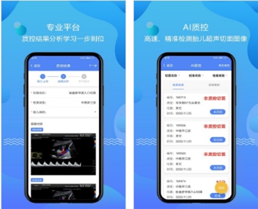 超声智库云会诊软件